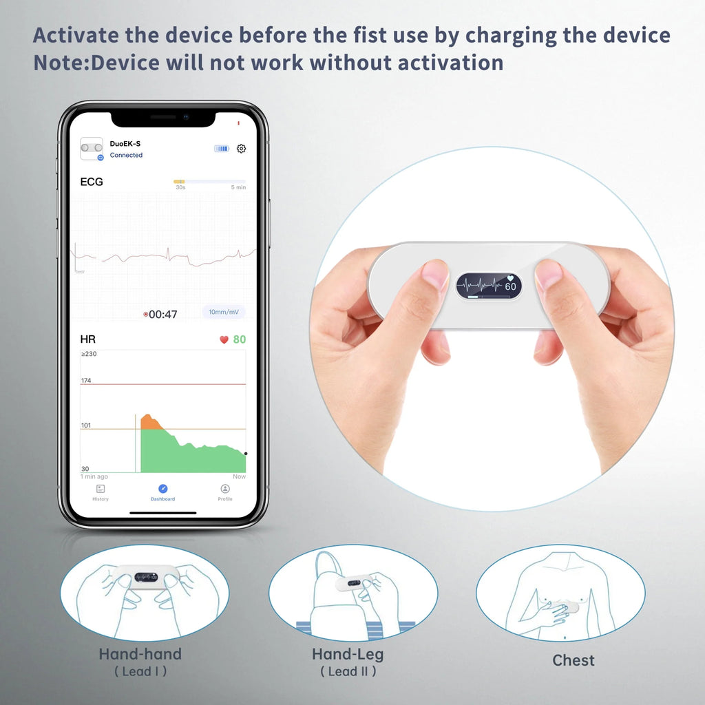 Handheld Bluetooth ECG Monitor with Screen Display P335862